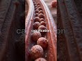 How Calcium Deposits Form in Blood Vessel