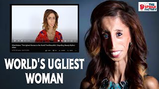What Makes World's Ugliest Woman Feel Beautiful | Lizzie Velasquez | TEDx
