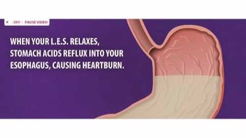 Prilosec OTC: How it Works