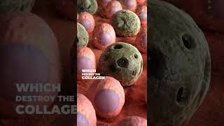The Zombie Cells Quietly Ageing Your Skin
