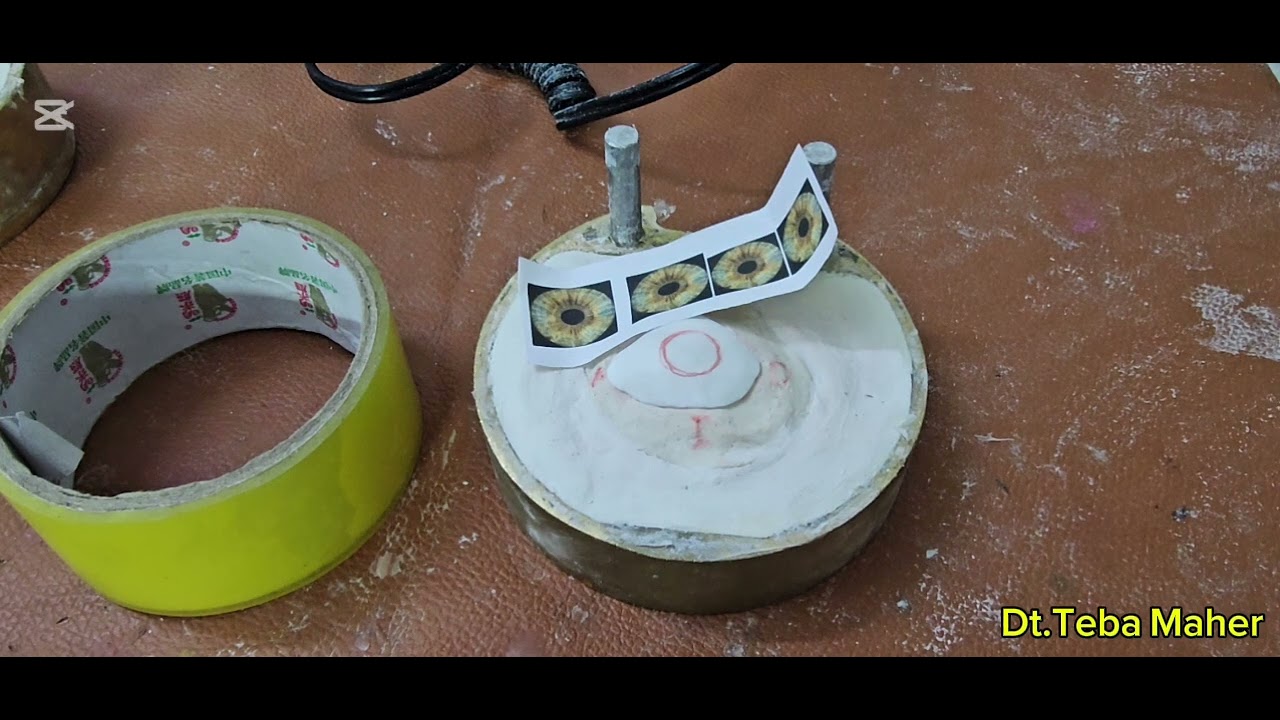 Wax elimination, packing and curing ocular, iris construction and blood vessels 