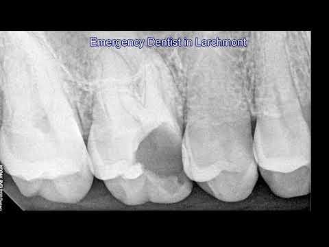 Emergency Dentist in