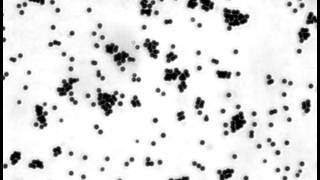 Active matter random walk of clusters