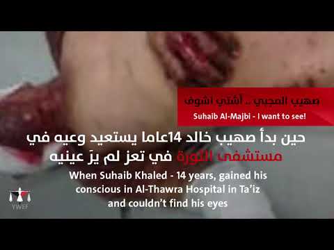 صهيب المجبي...أشتي أشوف! #١٠٠_حكاية_انسانية_من_اليمن #100_humanity_tale_from_yemen