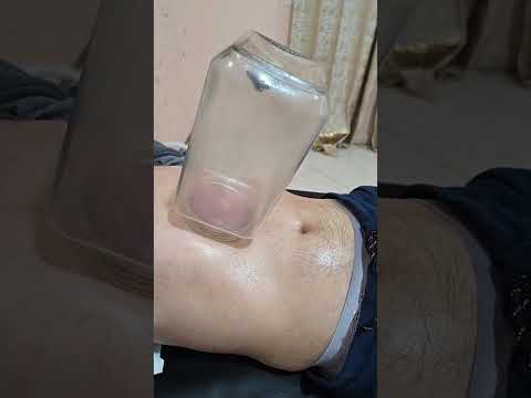 الطبيب قام له بمنظار واخبره بأنه يعاني من خلعة وخوف وسواس اكسبلور الشعب الصيني ماله حل 