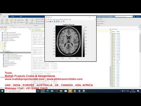 Medical image noise removal using CNN and image composition using MATLAB || MATLAB projects
