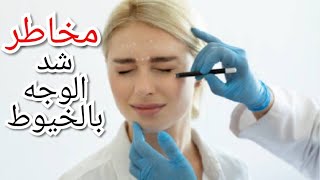 شد الوجه بالخيط يجعلك اكثر شباباً لكن هل تعلم ما هي مضاعفاته؟ | Dr Gild |