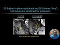 2025 Advanced Headache - MR Neurography - Dr. Darryl Sneag