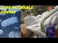 CURE INCURABLE DISEASE - Dr B M Hegde