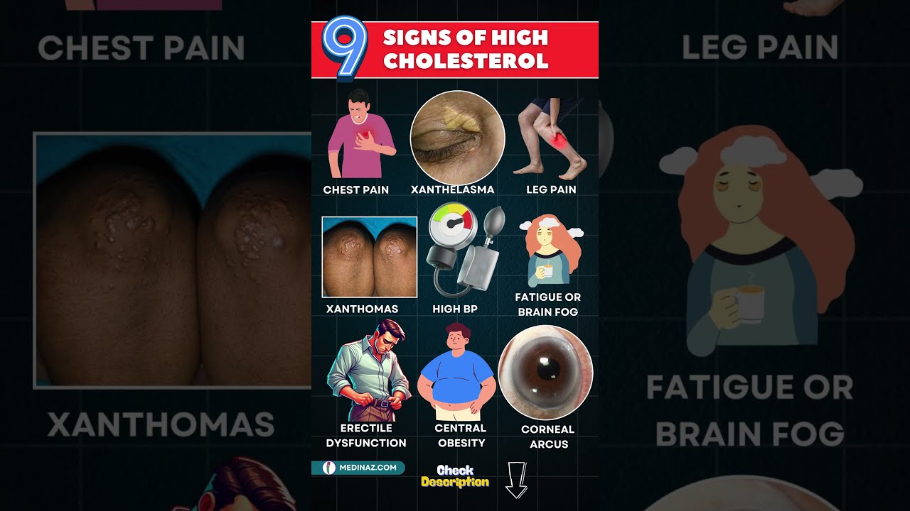 High Cholesterol Symptoms What Your Body Is Trying To Tell You