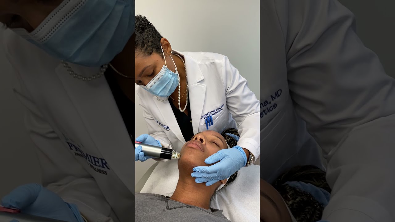 The Treatment Patients Choose for Firmer, Smoother Skin  • RF Microneedling in Norwalk CT 