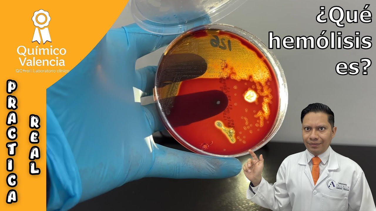 Кровяной агар: типы гемолиза объяснены на РЕАЛЬНЫХ ПРИМЕРАХ | Микробиология