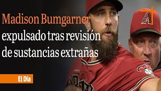 Madison Bumgarner expulsado tras revisión de sustancias extrañas; Payton con fractura en el codo