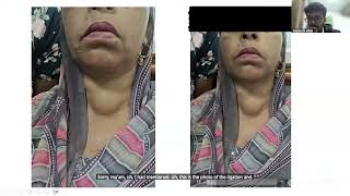 PG Masterclass- Thyroid Swelling