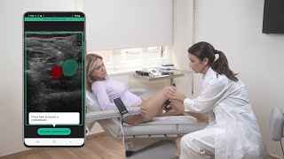 How ThinkSono AI Makes Ultrasound Imaging Quickly Accessible for Novices screenshot 4