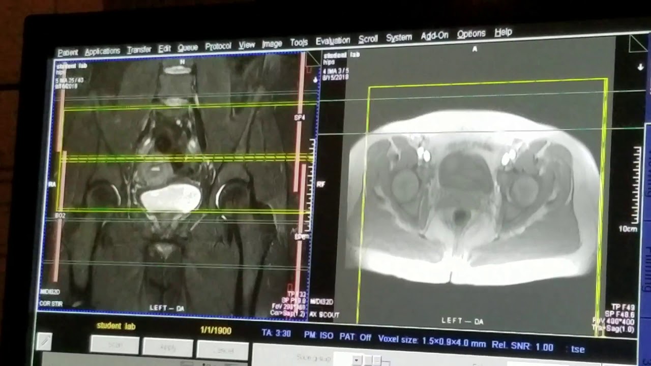 School of Medical Imaging MRI Lab Hip YouTube