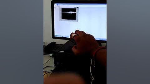 Surface EMG Behavior during hand movements.