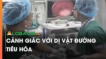 Cảnh giác với dị vật đường tiêu hóa