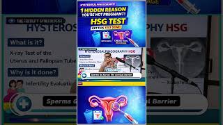 What Are Fallopian Tubes? #HSG #shortsfeed #youtubeshorts