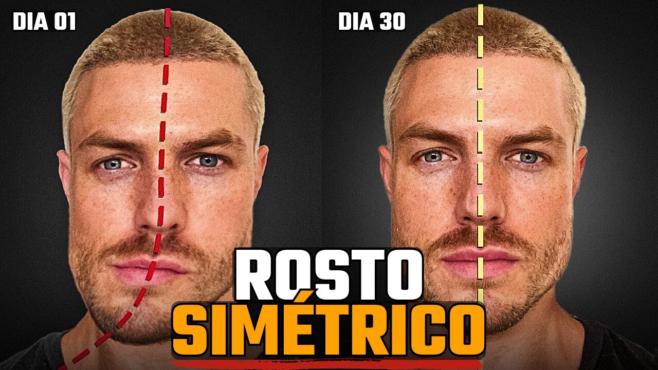 Como ACABAR com a ASSIMETRIA da MANDÍBULA e do ROSTO (PARA SEMPRE)