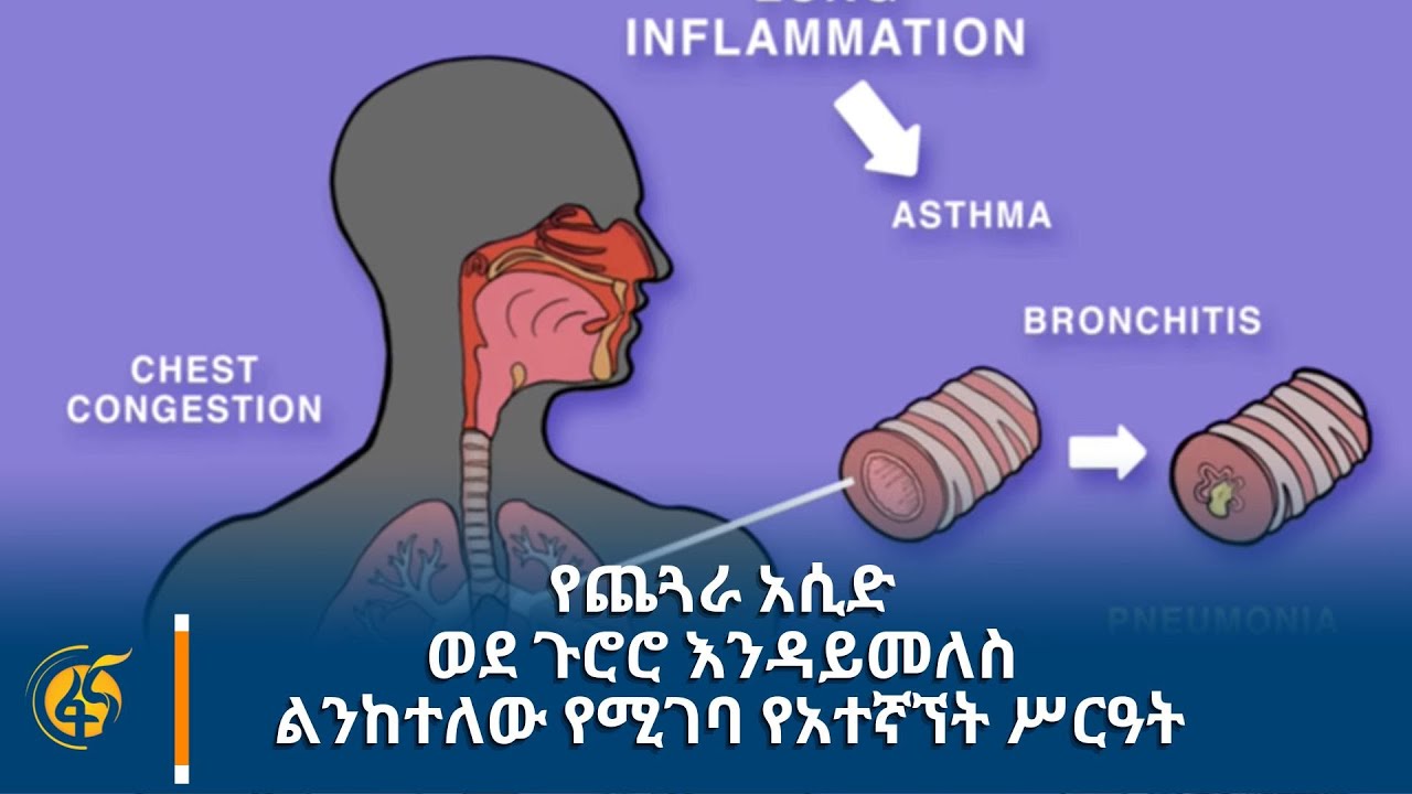 የጨጓራ አሲድ ወደ ጉሮሮ እንዳይመለስ ልንከተለው የሚገባ የአተኛኘት ሥርዓት