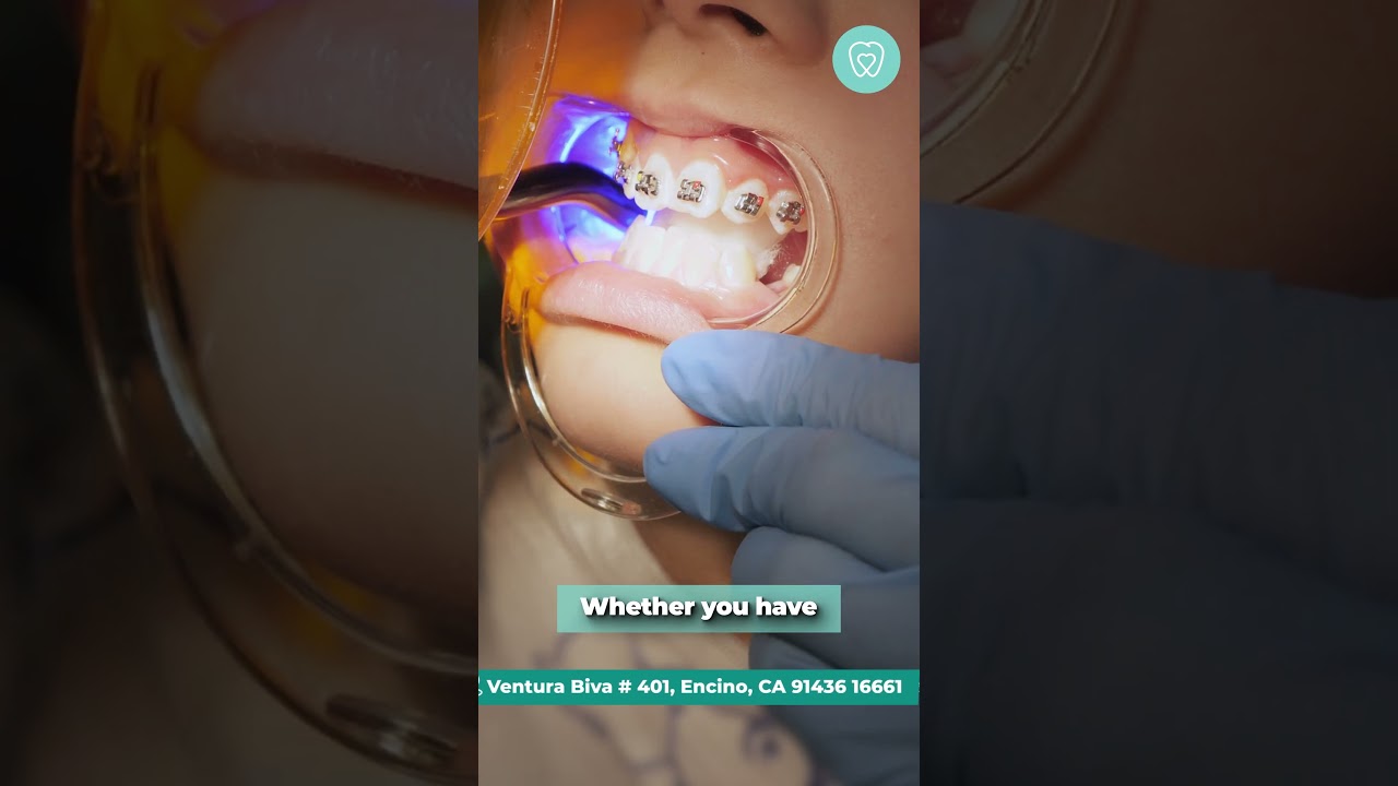 ✨The Path to a Perfect Smile 