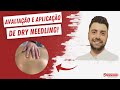 Olha o que acontece aplicando DRY NEEDLING NO MÚSCULO ROMBOIDE?!