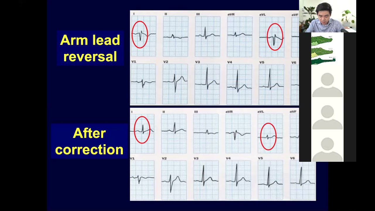 Basic Cardiology for Extern (to be)