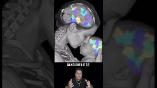 você sabe o que é microquimerismo? #curiosidades #saúde #medico #pediatra