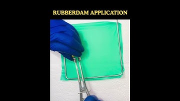 Rubber Dam Application in 40 Seconds! Rubber dam placement#shorts