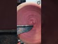 Turning BURL into a BOWL - ASMR