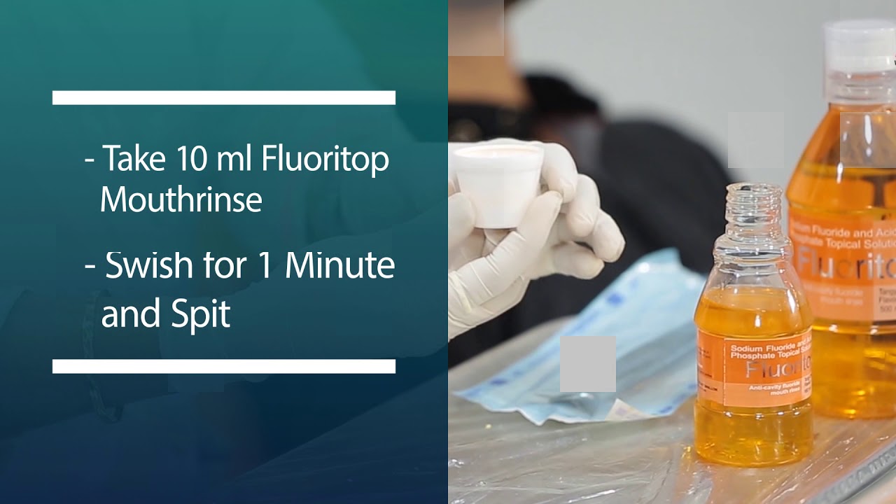 How to Use Fluoritop Mouthrinse for Extended Caries Protection YouTube