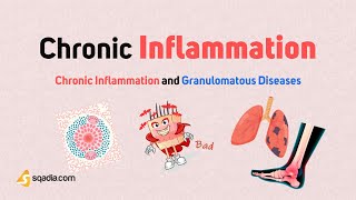 Chronic Inflammation and Granulomatous Diseases | Chronic Inflammation | Immunology
