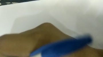 If the stick is broken into 3 parts, what is the probability that they will form a triangle?