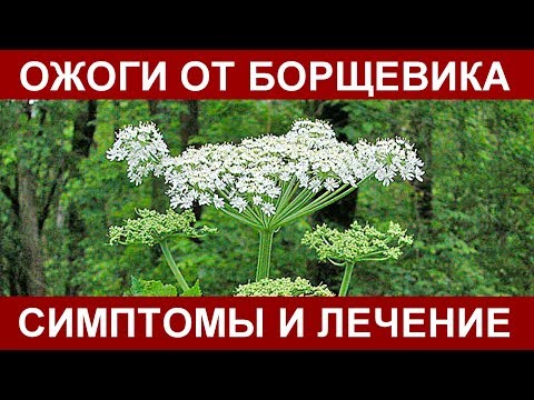 Вопрос: Как лечить ковровые ожоги?