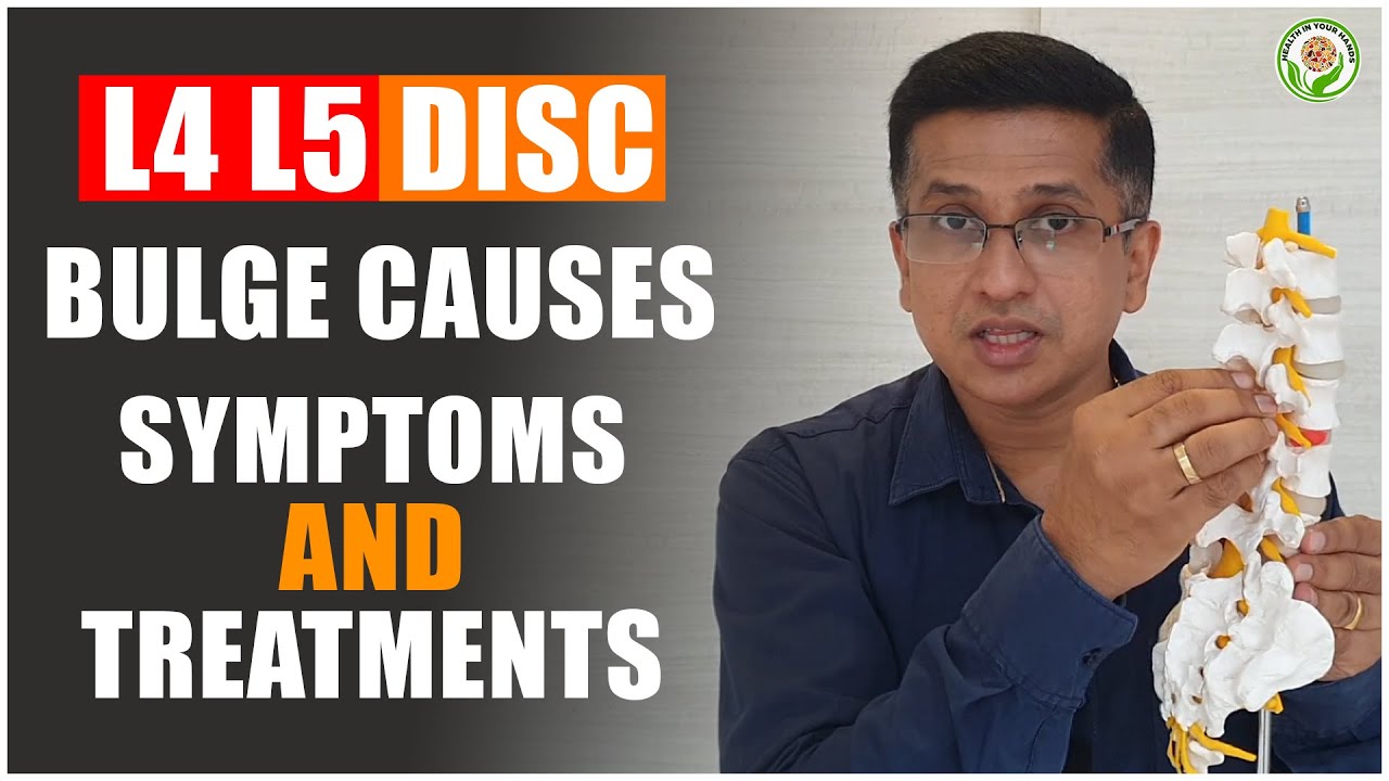 l4 l5 DISC BULGE CAUSES, SYMPTOMS AND TREATMENTS | (L4 L5 ನ ಕಾರಣಗಳು  ಲಕ್ಷಣಗಳು ಮತ್ತು ಚಿಕಿತ್ಸೆ )