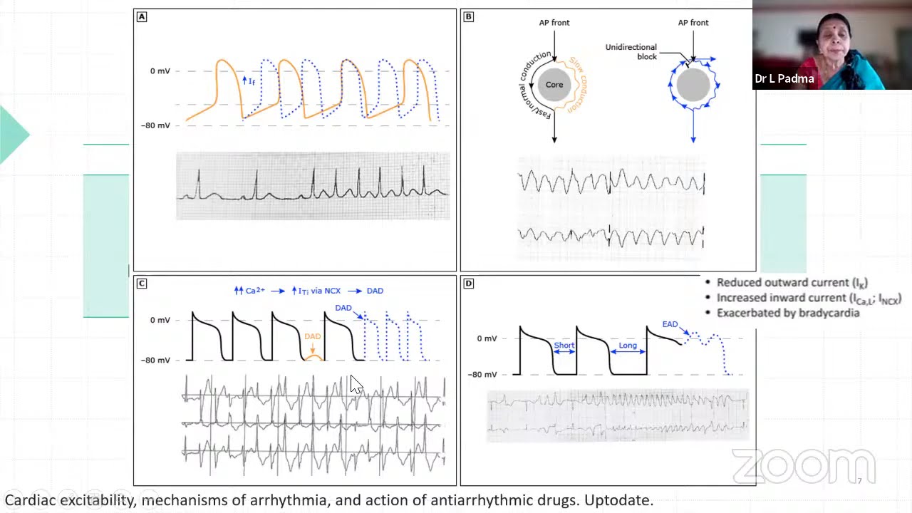 ANTIARRHYTHMICS | Dr Padma