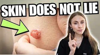 What Obesity Does to Your Skin (That No One Talks About)