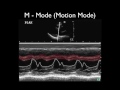 Ultrasound Physics Scanning Modes M Mode