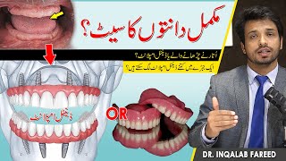 Dental Implants Or Removable Denture Whats The Best Solution For You?