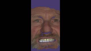 design the perfect smile #shortvideo #smiledesigndental #dentalartistry#shorts #shortsfeed #dentist