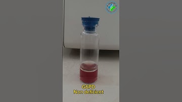 G6PD test | Glucose 6 phosphate dehydrogenase test | negative G6PD | Hematology #medicallaboratory
