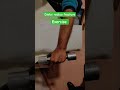 distal radius fracture ka exercise || physiotherapy treatment #physiotherapy #doctor #shorts