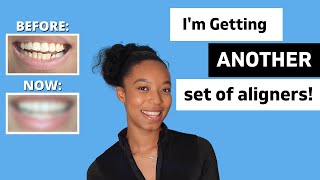Invisalign Update | 7 Months later!