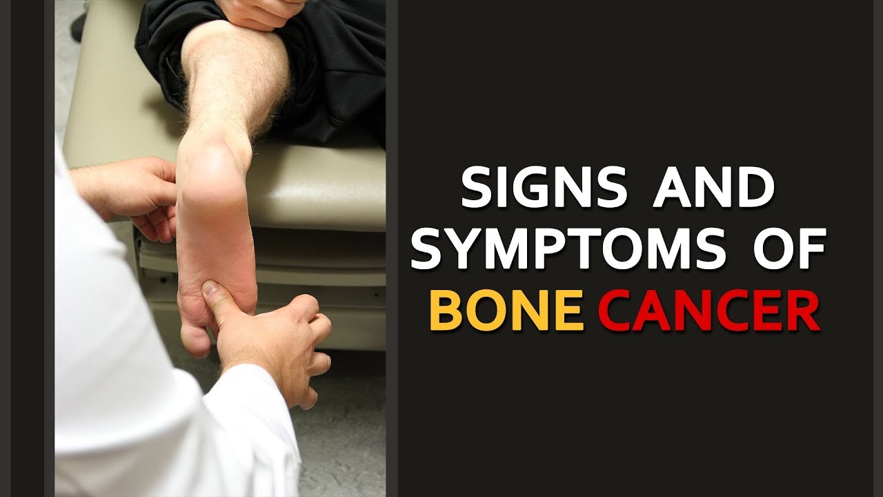 Signs And Symptoms of bone cancer-Dr.Anwar Amir ansari ...