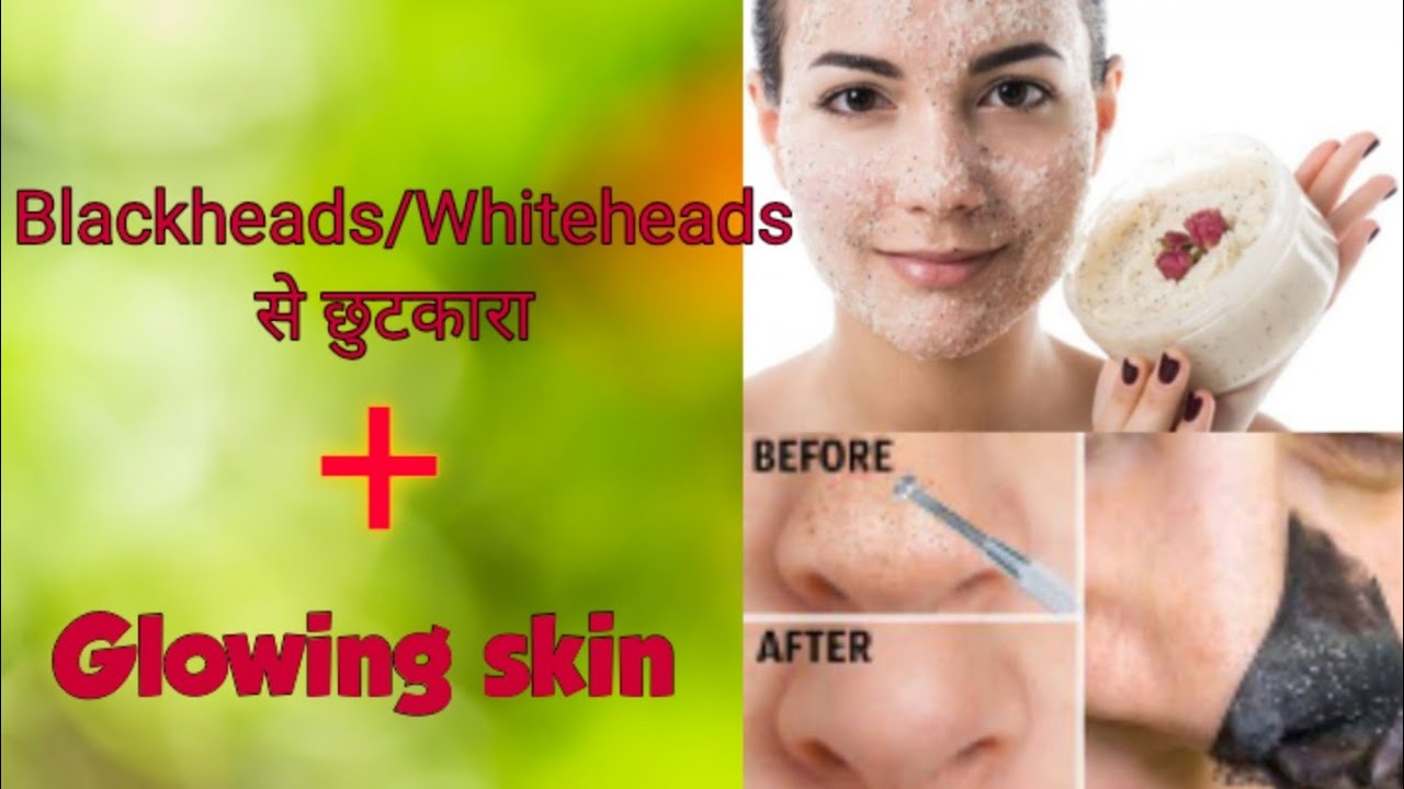 Natural Scrub with glowing skin, blackheads/ whiteheads से छुटकारा