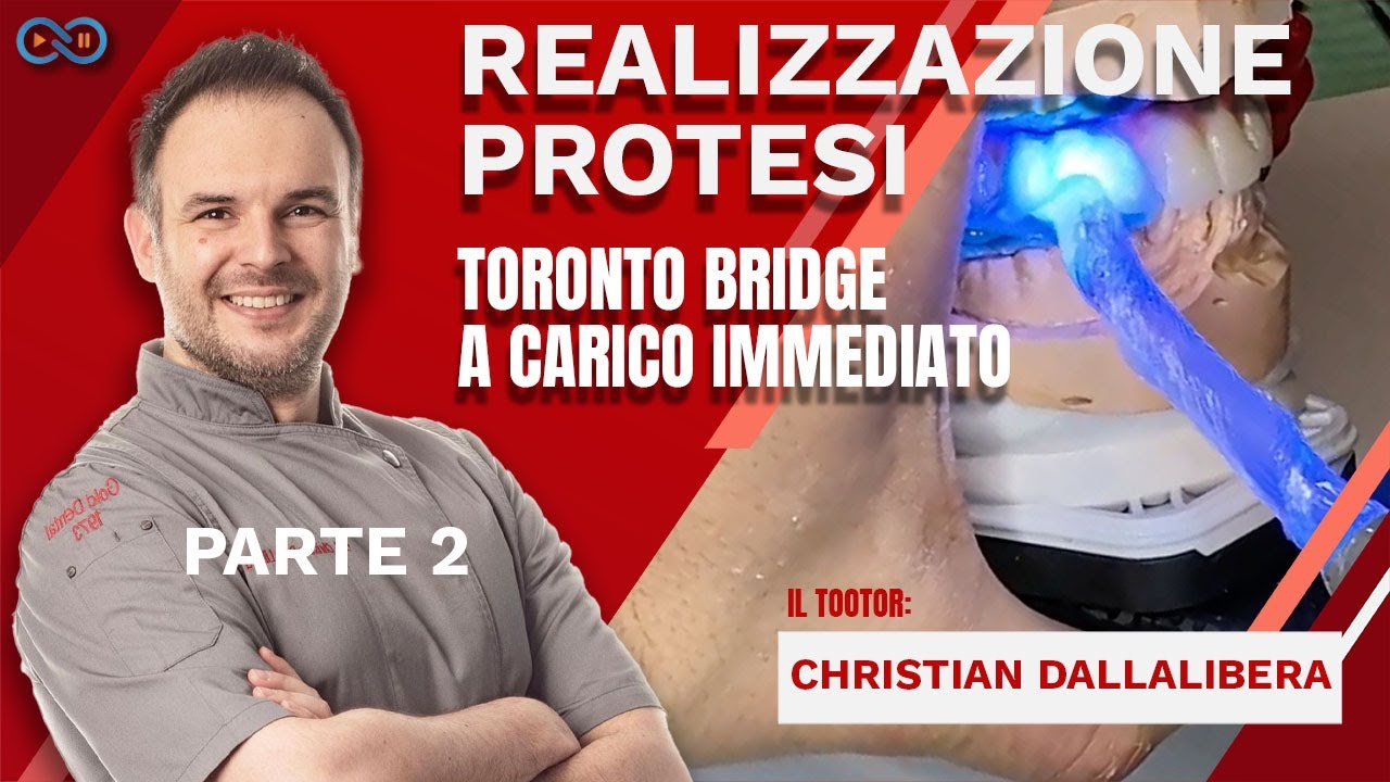 Realizzazione Protesi Toronto Bridge A Carico Immediato YouTube