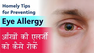 Eye Allergy Treatment- Easy tips from Eye surgeon to manage Eye Allergy आंखों में जलन का आसान इलाज
