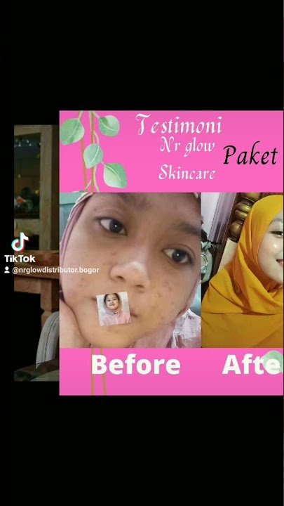 glow dulu biar tambah pd yu order nr glow skincare 085773400221