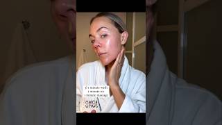 How To Prevent Travel Acne